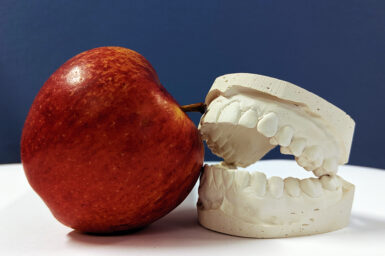 Red apple with white plaster cast of teeth